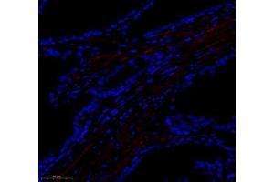 Immunofluorescence of paraffin embedded human prostate using paldadin (ABIN7074976) at dilution of 1: 500 (300x lens) (PALLD anticorps)
