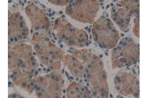 Detection of MYH10 in Human Stomach Tissue using Polyclonal Antibody to Myosin Heavy Chain 10, Non Muscle (MYH10)