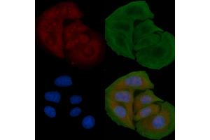 ABIN6259321 and ABIN6274774 staining Hela cells by IF/ICC. (RPL26L anticorps  (C-Term))