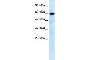 Mucolipin 1 antibody used at 0. (MCOLN1 anticorps  (N-Term))