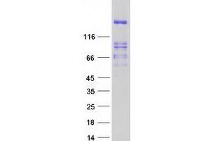 Validation with Western Blot