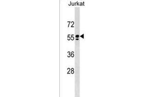 SM1 Antibody (C-term)  western blot analysis in Jurkat cell line lysates (35 μg/lane).