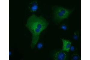 Immunofluorescence (IF) image for anti-Kelch-Like 2, Mayven (KLHL2) (AA 1-100), (AA 494-593) antibody (ABIN1490548) (KLHL2 anticorps  (AA 1-100, AA 494-593))