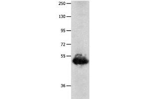 Western Blot analysis of Human lung cancer tissue using BPIFB3 Polyclonal Antibody at dilution of 1:1600 (BPIFB3 anticorps)