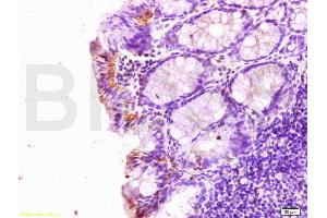 Formalin-fixed and paraffin embedded rat colitis labeled with Rabbit Anti SLC40A1 Polyclonal Antibody, Unconjugated (ABIN701095) at 1:200 followed by conjugation to the secondary antibody and DAB staining (SLC40A1 anticorps)