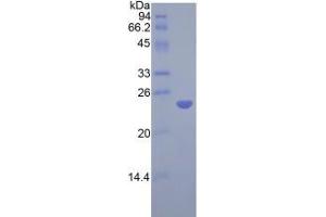 SDS-PAGE analysis of Rat COMT Protein. (COMT Protéine)
