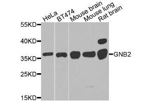 Western blot analysis of extracts of various cell lines, using GNB2 antibody.
