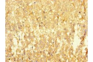 Immunohistochemistry of paraffin-embedded human adrenal gland tissue using ABIN7167753 at dilution of 1:100 (RTN4IP1 anticorps  (AA 41-396))