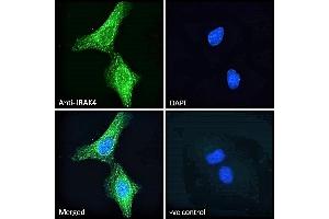 ABIN185338 Immunofluorescence analysis of paraformaldehyde fixed HeLa cells, permeabilized with 0.