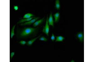 Immunofluorescence staining of Hela cells with ABIN7162684 at 1:200, counter-stained with DAPI. (PASK anticorps  (AA 482-602))