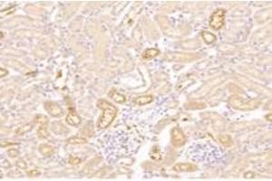 Immunohistochemistry analysis of paraffin-embedded mouse kidney using,CTSV (ABIN7073348) at dilution of 1: 2000 (Cathepsin L2 anticorps)