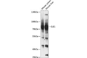 Western blot analysis of extracts of various cell lines, using GLE1 antibody (ABIN6131943, ABIN6141121, ABIN6141123 and ABIN6217118) at 1:3000 dilution. (GLE1 anticorps  (AA 1-300))