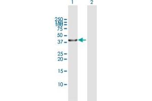 Western Blot analysis of SERPINB3 expression in transfected 293T cell line by SERPINB3 MaxPab polyclonal antibody. (SERPINB3 anticorps  (AA 1-390))
