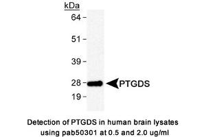 Image no. 1 for anti-Prostaglandin D2 Synthase (PTGDS) antibody (ABIN363610) (PTGDS anticorps)