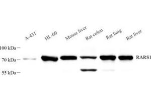 Western blot analysis of RARS (ABIN7073119),at dilution of 1: 2000 (RARS anticorps)