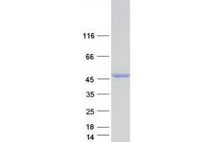 Validation with Western Blot