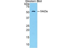 Western blot analysis of the recombinant protein. (TFF3 anticorps  (AA 23-81))