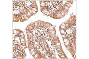 Immunohistochemistry of ZBP1 in human small intestine tissue with ZBP1 antibody at 2. (ZBP1 anticorps  (C-Term))