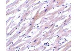 Immunohistochemistry of UNG1 in human heart tissue with this product at 2 μg/ml. (UNG anticorps  (N-Term))