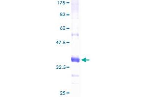 CTBS Protein (AA 37-105) (GST tag)