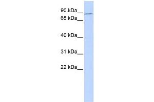 WB Suggested Anti-TBX2 Antibody Titration:  0. (TBX2 anticorps  (Middle Region))