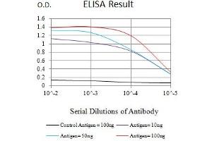 Black line: Control Antigen (100 ng),Purple line: Antigen (10 ng), Blue line: Antigen (50 ng), Red line:Antigen (100 ng)