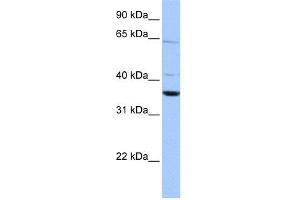 WB Suggested Anti-CNN2 Antibody Titration: 0. (CNN2 anticorps  (N-Term))