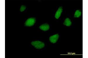 Immunofluorescence of purified MaxPab antibody to STK36 on HeLa cell. (STK36 anticorps  (AA 1-1315))