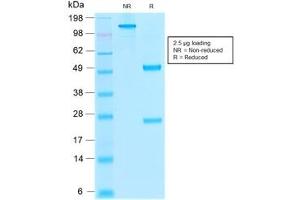 SDS-PAGE analysis of purified, BSA-free recombinant Thrombomodulin antibody (clone rTHBD/1591) as confirmation of integrity and purity.