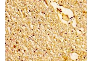 IHC image of ABIN7160954 diluted at 1:200 and staining in paraffin-embedded human brain tissue performed on a Leica BondTM system. (NDUFS2 anticorps  (AA 297-427))