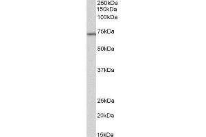 ABIN2560413 (2µg/ml) staining of Daudi lysate (35µg protein in RIPA buffer). (TICAM1 anticorps)