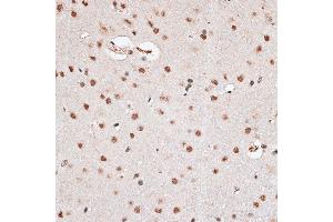 Immunohistochemistry of paraffin-embedded rat brain using RBM3 antibody  at dilution of 1:100 (40x lens).