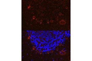 Immunofluorescence analysis of mouse brain cells using  Rabbit pAb (ABIN6131182, ABIN6136830, ABIN6136831 and ABIN6222940) at dilution of 1:100 (40x lens).
