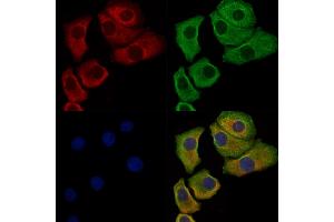 Phospho-Paxillin (Ser178) Antibody staining Hela cells(heat shock treatment) by IF/ICC. (Paxillin anticorps  (pSer178))