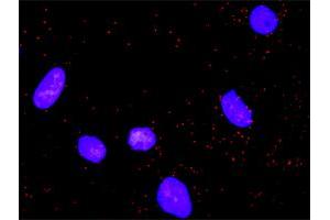 Proximity Ligation Analysis of protein-protein interactions between NFKB1 and CD82.