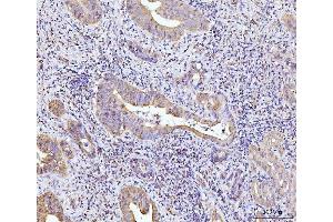 IHC analysis of Glutaminase/GLS using anti-Glutaminase/GLS antibody (ABIN7601601). (Glutaminase anticorps  (AA 396-654))