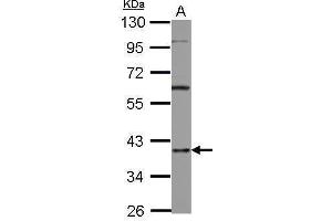 WB Image Sample (30 ug of whole cell lysate) A: A431 10% SDS PAGE antibody diluted at 1:1000 (HNRNPD/AUF1 anticorps)