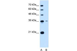 Tetraspanin 5 antibody used at 0. (Tetraspanin 5 anticorps  (Middle Region))
