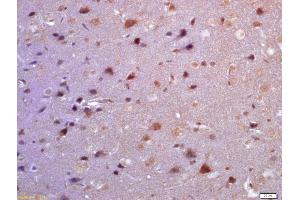 Formalin-fixed and paraffin embedded rat brain labeled with Anti-TSSC3 Polyclonal Antibody, Unconjugated (ABIN872459) at 1:200 followed by conjugation to the secondary antibody and DAB staining (PHLDA2 anticorps  (AA 31-80))