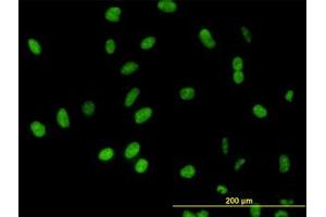 Image no. 3 for anti-DEAD (Asp-Glu-Ala-Asp) Box Polypeptide 54 (DDX54) (AA 778-882) antibody (ABIN599302) (DDX54 anticorps  (AA 778-882))
