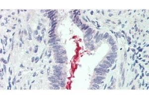 Immunohistochemistry of paraffin-embedded Lung tissue using IL19 Polyclonal Antibody at dilution of 1:90 .