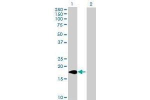Lane 1: ARL2BP transfected lysate ( 18. (ARL2BP 293T Cell Transient Overexpression Lysate(Denatured))