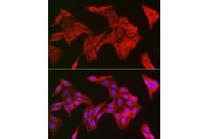 Immunofluorescence analysis of NIH/3T3 cells using TRIM21/SS-A Rabbit pAb (ABIN6131376, ABIN6149506, ABIN6149507 and ABIN6217587) at dilution of 1:150 (40x lens). (TRIM21 anticorps  (AA 80-330))