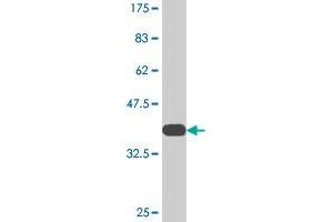 Western Blot detection against Immunogen (37.