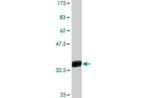 Western Blot detection against Immunogen (38. (CXCL5 anticorps  (AA 1-114))