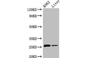 Western Blot Positive WB detected in: K562 whole cell lysate, Mouse liver tissue All lanes: NQO2 antibody at 3 μg/mL Secondary Goat polyclonal to rabbit IgG at 1/50000 dilution Predicted band size: 26 kDa Observed band size: 26 kDa (NQO2 anticorps  (AA 1-231))