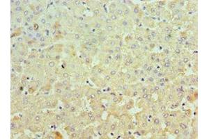 Immunohistochemistry of paraffin-embedded human liver tissue using ABIN7150332 at dilution of 1:100