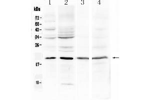 Western blot analysis of Myoglobin using anti-Myoglobin antibody . (MB anticorps  (N-Term))