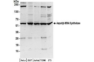 Western Blotting (WB) image for anti-Aspartyl-tRNA Synthetase (DARS) (AA 25-75) antibody (ABIN7449994)