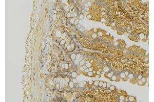 ABIN6276324 at 1/100 staining Mouse colon tissue by IHC-P.